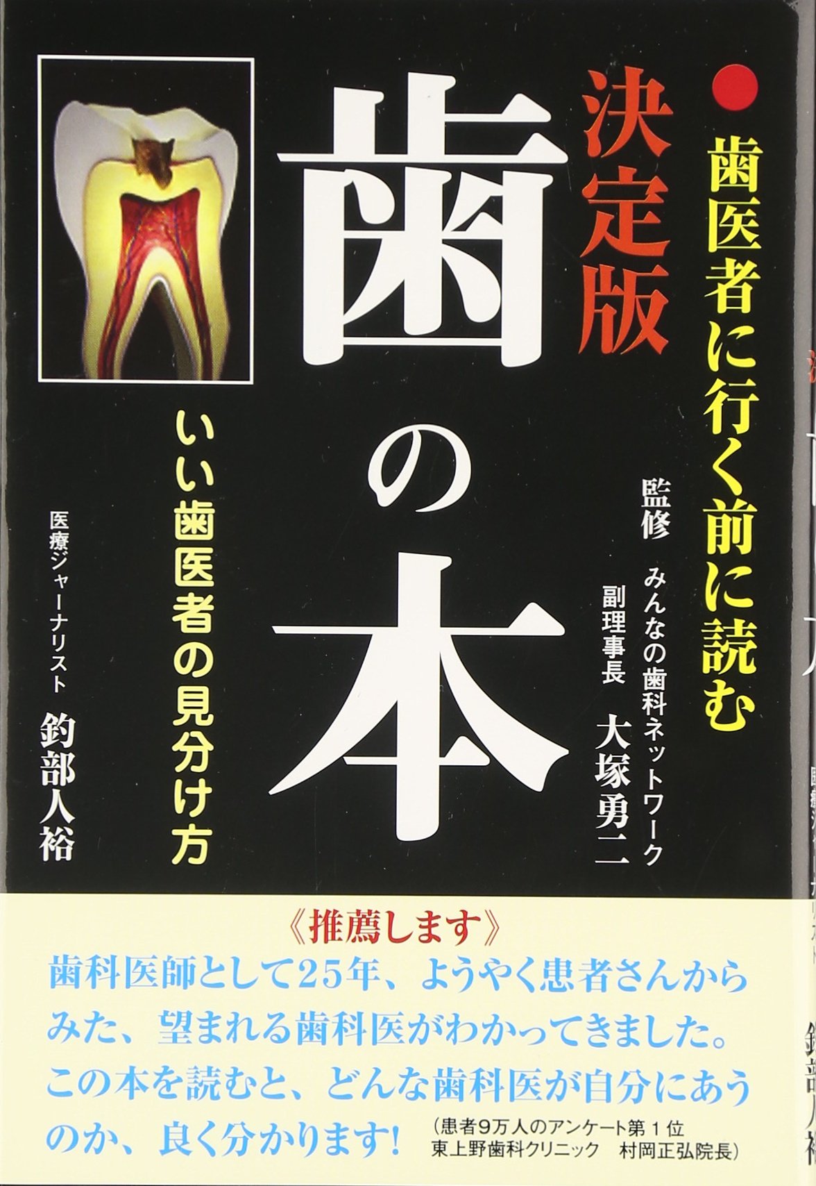 歯の本 決定版: 歯医者に行く前に読む いい歯医者の見分け方 | 釣部 人