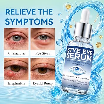 Stye Eye Treatment Serum for Irritation Relief, Soothing Formula for Stye and Chalazion Care, Gentle Daily Use Eye Serum, Helps Reduce Redness and Puffiness, Easy Dropper Application, 30ML