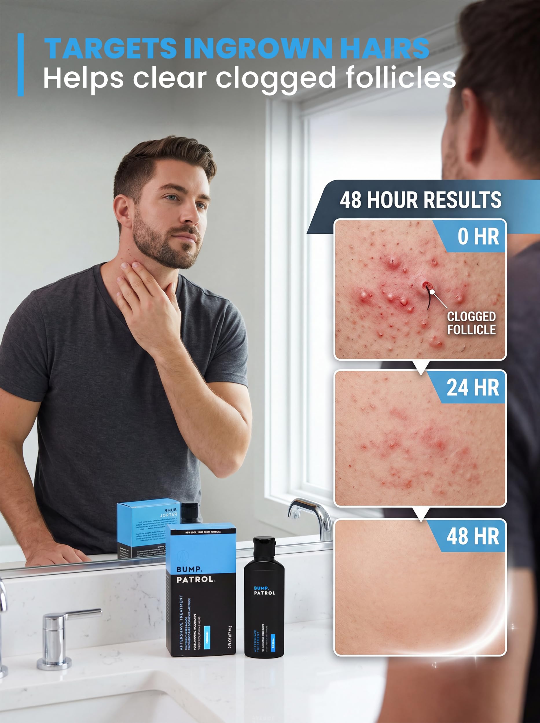 Bump Patrol After Shave 60 ml Intensive Treatment (Packung mit 2)