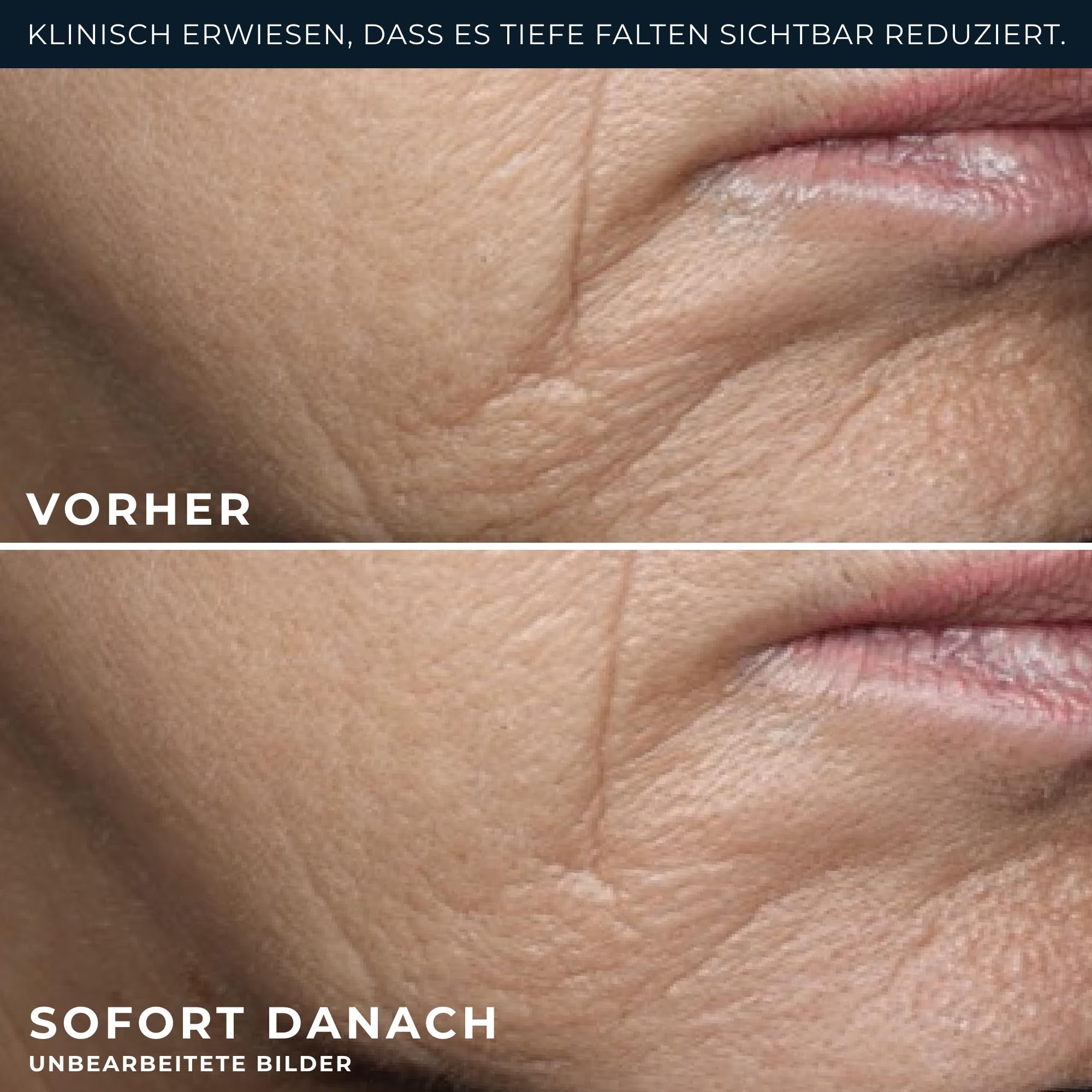 RoC Retinol Correxion Deep Wrinkle Rich Cream | mit Bio-Ceramiden & Calcium, ohne Duftstoffe | 50 ml