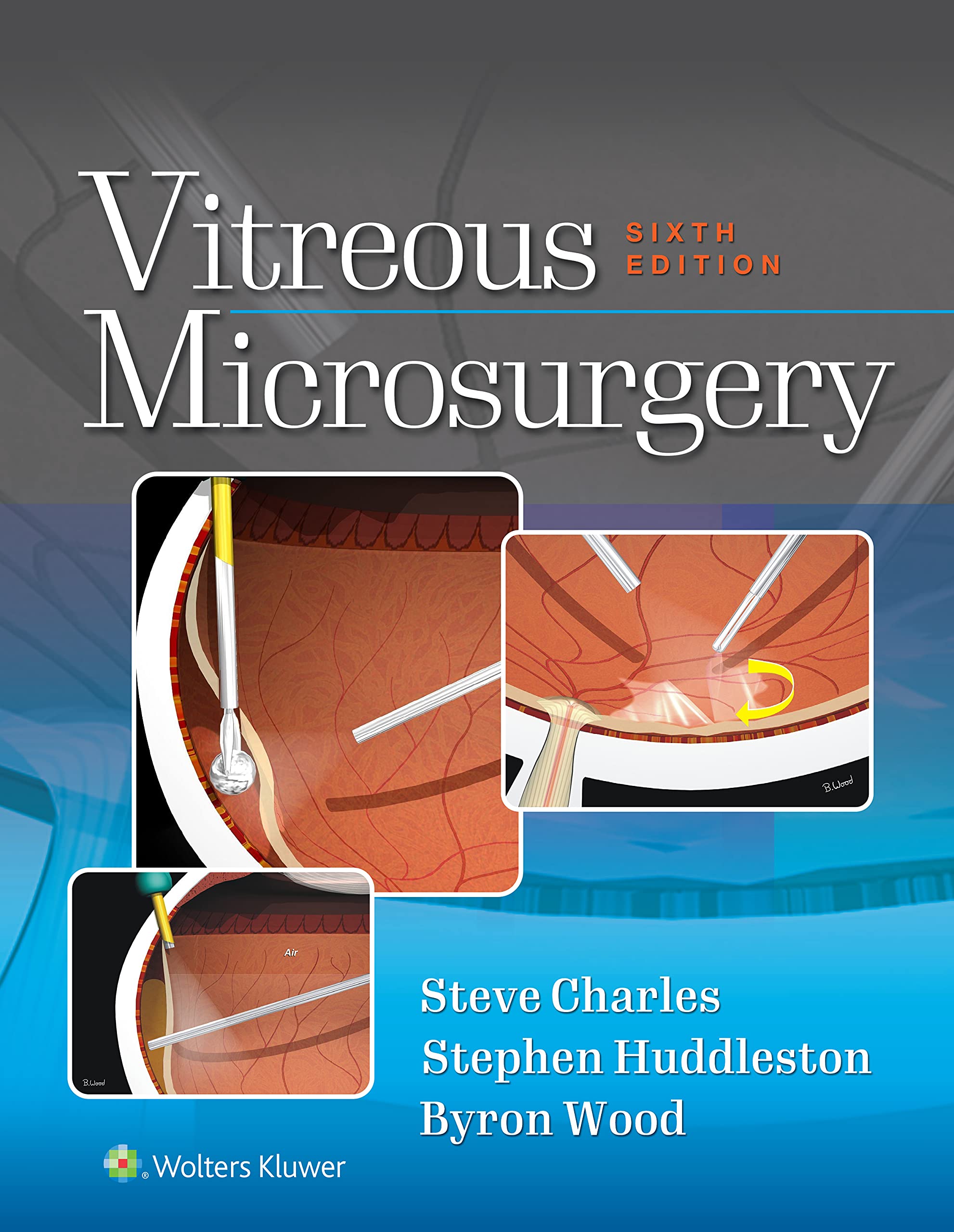 Vitreous Microsurgery (English Edition)