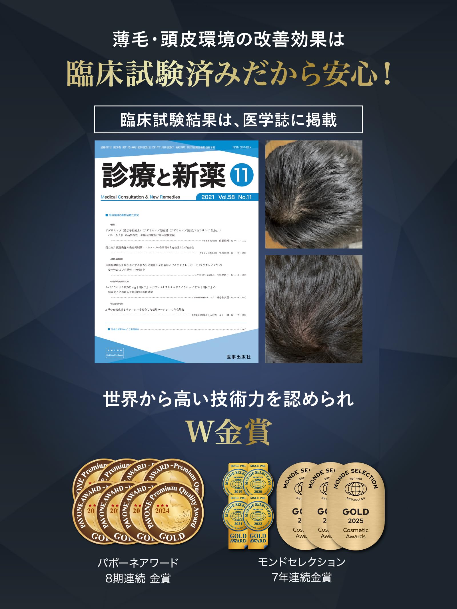 Amazon | REDEN リデン 【公式店限定返金保証書付き】薬用 育毛剤