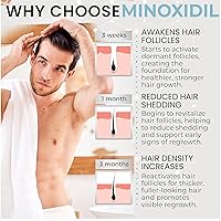 Vista 4 de Remixidil - Espuma de minoxidil al 5% para hombre Tratamiento de crecimiento capilar para hombres Fórmula clínicamente probada para la pérdida