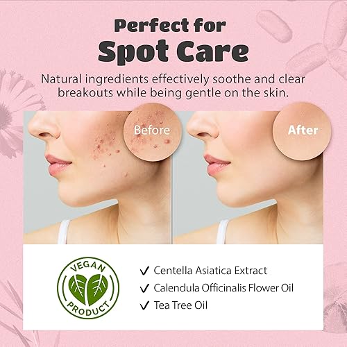 Miniatura 6 de lattcare - Tiras de poros de nariz de carbón 6 piezas  Parches de protección de la piel Dalgona 15 piezas  Eliminador de puntos negros limpieza