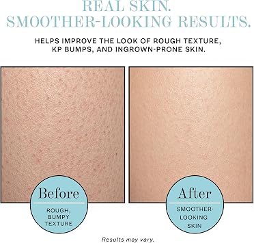 Base Laboratories Ingrown Hair - KP Bump Exfoliating Body Scrub - with AHA+BHA - Keratosis Pilaris Treatment - Daily Skin Exfoliant - Helps Reduce Strawberry Skin & Razor Bumps - Men & Women 90ml