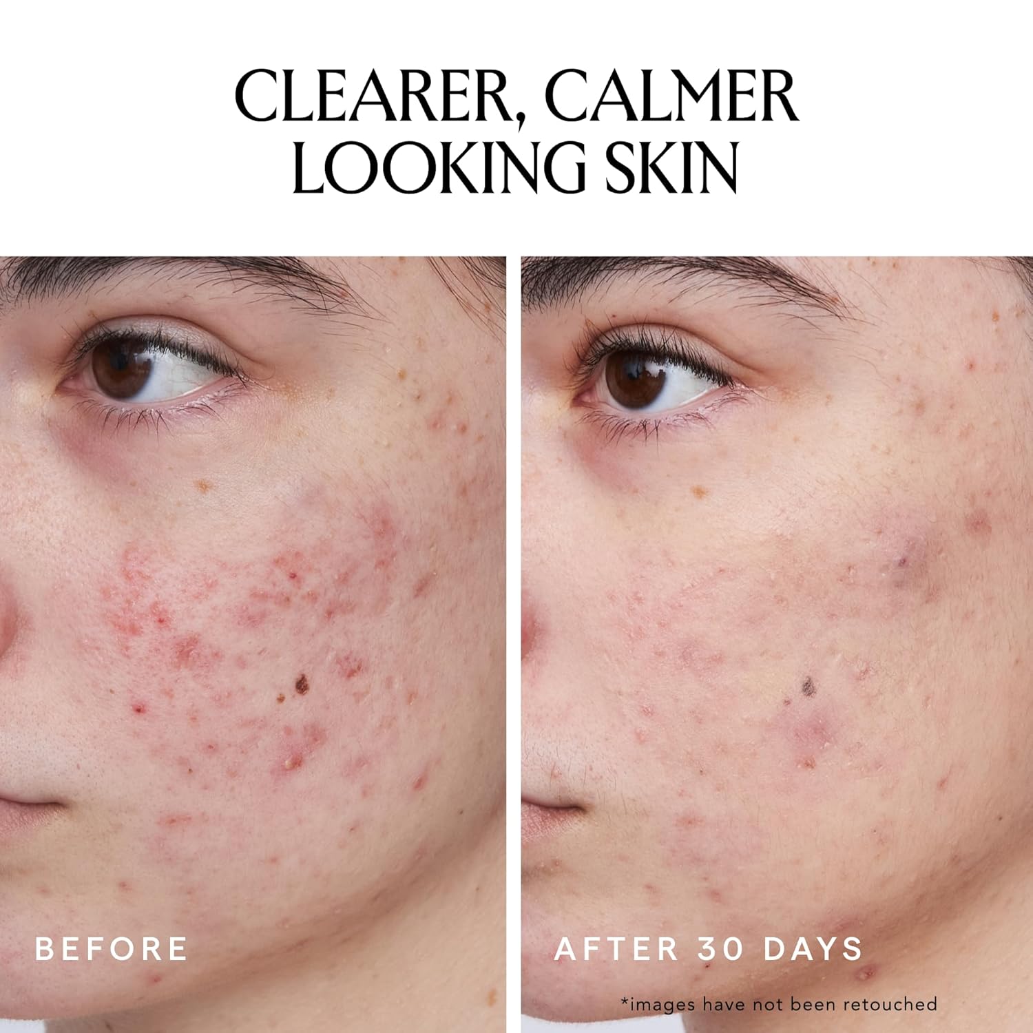 HERBIVORE Blue Wave Clearing Serum Acne Treatment | 2% Salicylic Acid + Blue Tansy + Willow Bark, Plant-based, Vegan, Cruelty-free, 30mL /1 oz - Image 4