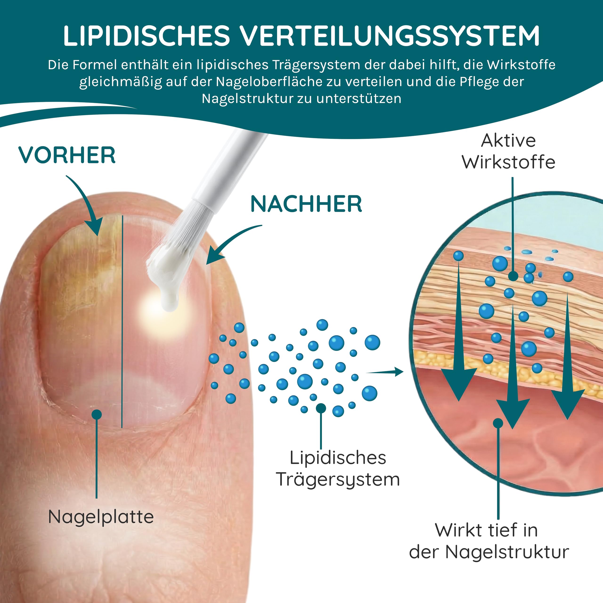 LENIMOR® NP1 | PREMIUM NAGELPILZ 2-in-1 für schöne & gesunde Nägel 10ml | CE-Medizinprodukt | Natürliche Formel mit Teebaumöl & Vitamin E | Nagelhärter | Made in Italy