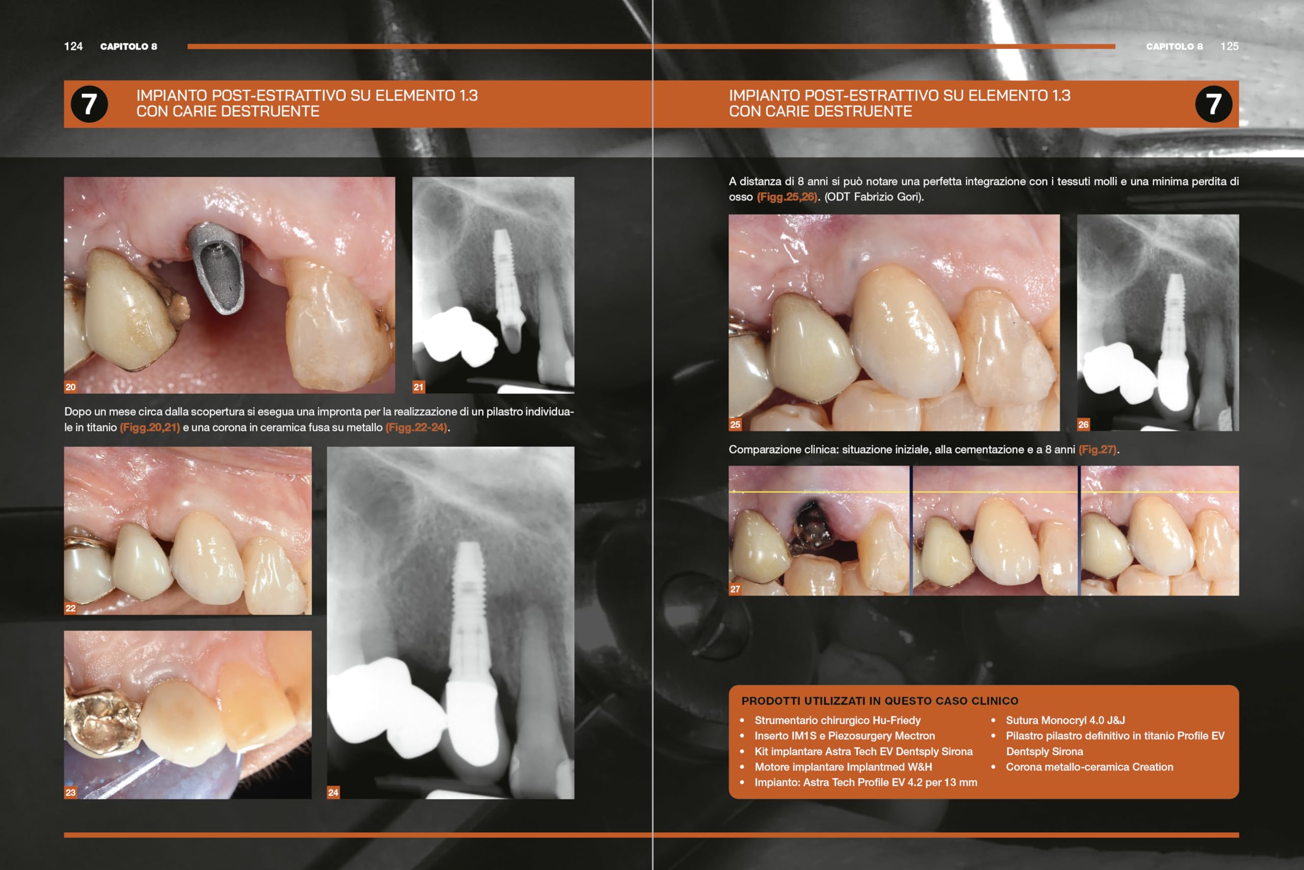 Impianti immediati. Manuale clinico operativo con procedure step by step