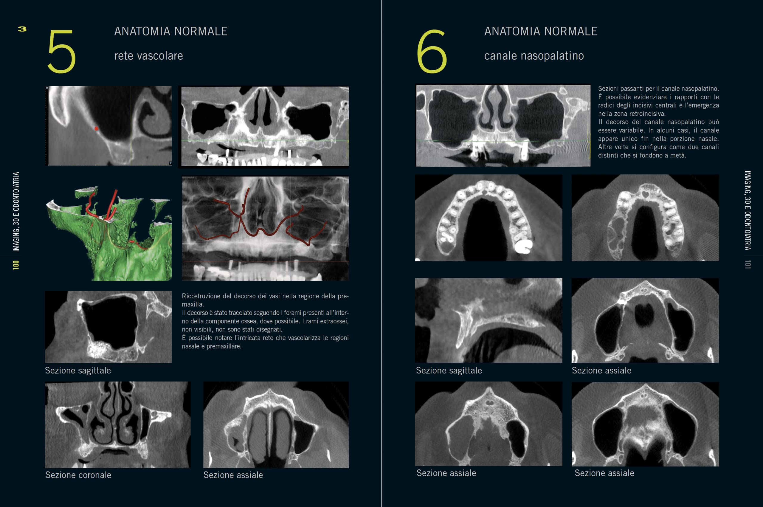 Imaging, 3D e odontoiatria. Dalla cefalometria multiplanare alla navigazione guidata in implantologia