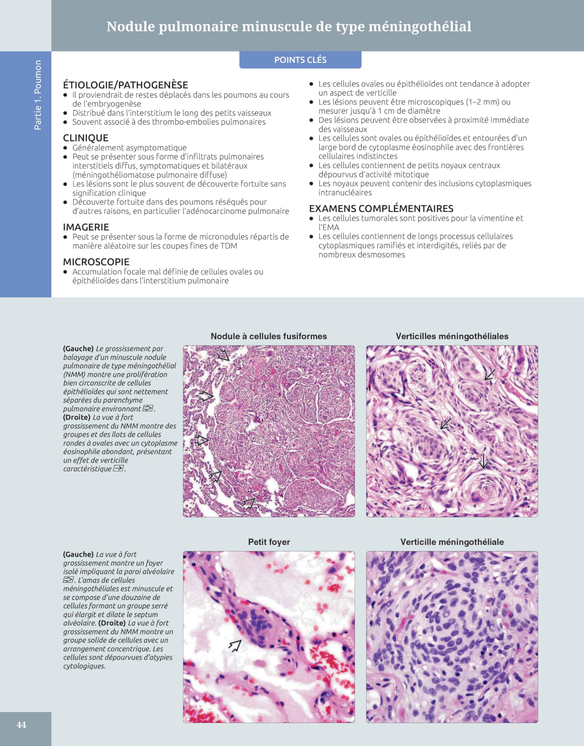 Diagnostic en pathologie thoracique