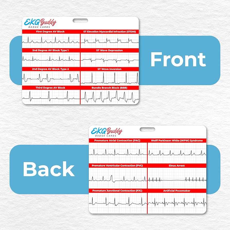 Amazon.com : EKG Buddy's 5 Card EKG Interpretation Badge Set - Doubled Sided Nurse ECG Cards Guide Rhythm Cheat Sheet, EKG Telemetry Strips for ACLS Medical Cardiac Reference and Nursing Student Gift amazon-com-ekg-buddy-s-5-card-ekg-interpretation-badge-set-doubled-sided-nurse-ecg-cards-guide-rhythm-cheat-sheet-ekg-telemetry-strips-for-acls-medical-cardiac-reference-and-nursing-student-gift