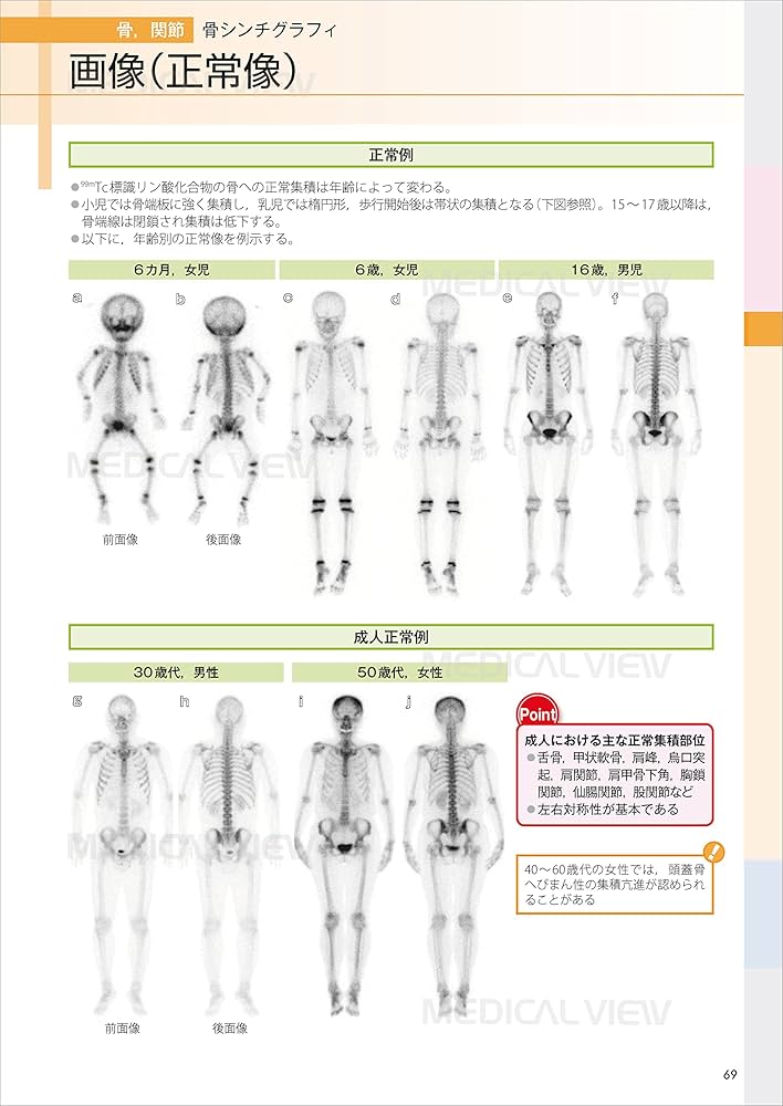 症例に学ぶ核医学画像アトラス 大型本（大型本） 71HWtoSpxyL.jpg