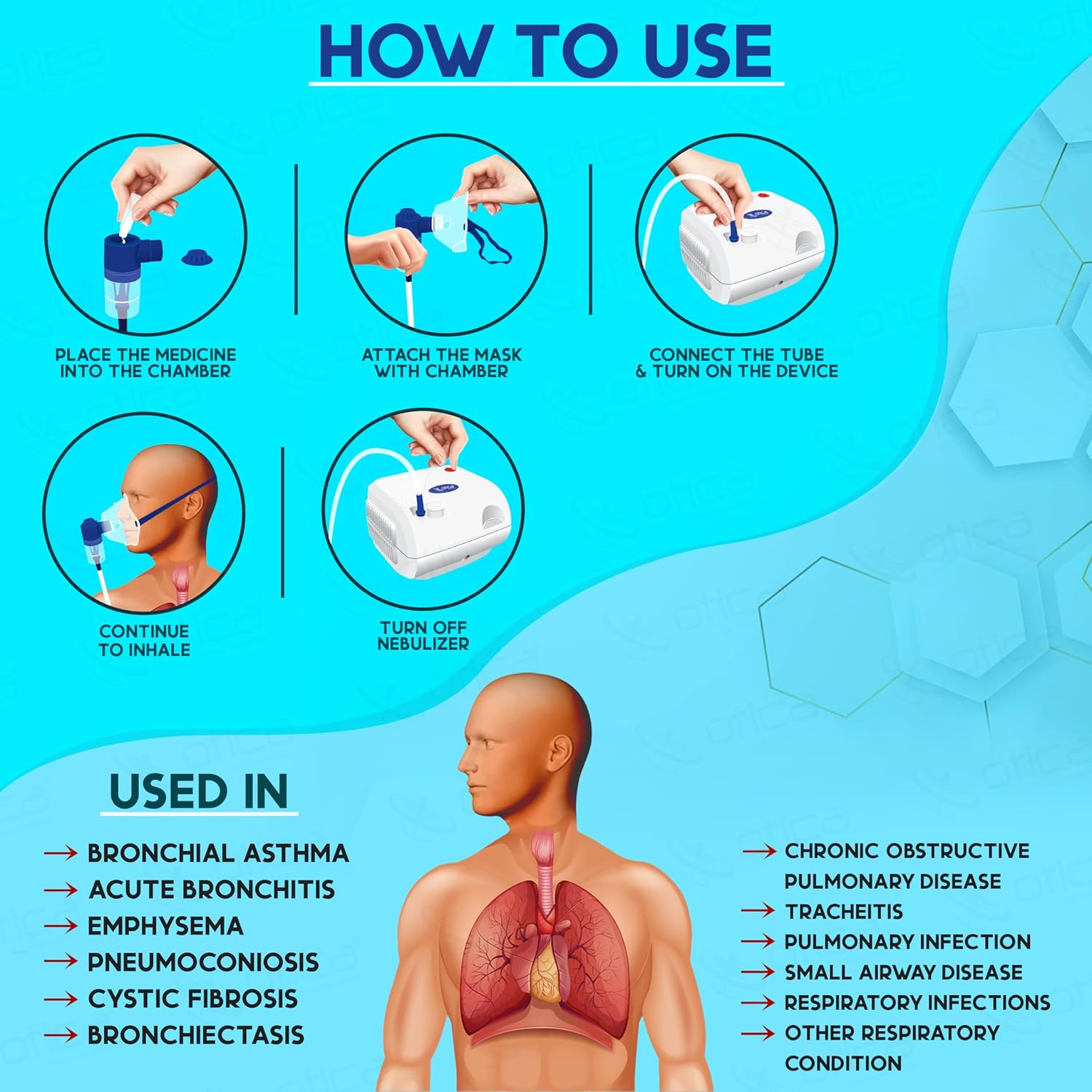 OTICA Hospital Nebulizer Machine for Child and Adults (Pure Copper Motor) OTICA Hospital Nebulizer Machine for Child and Adults (Pure Copper Motor)