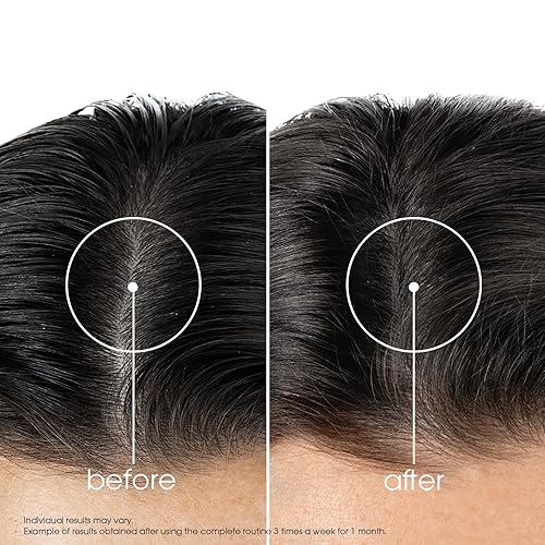 Miniatura 6 de Klorane Strengthening Shampoo with Quinine and Edelweiss for Thinning Hair, Supports Thicker, Stronger, Healthier Hair, For Men and Women Paraben,