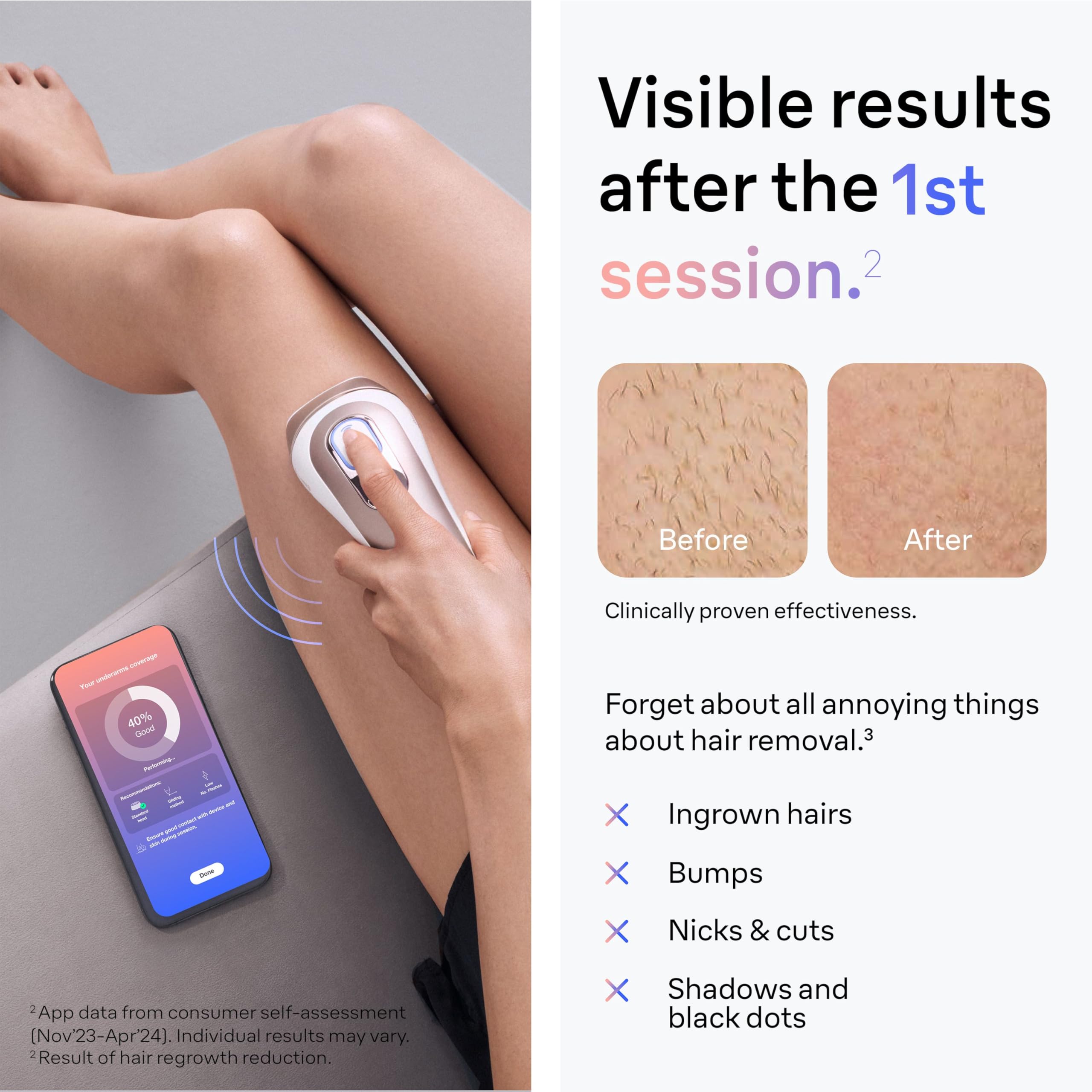 Braun Smart IPL, Skin i·Expert Pro 7, VOGUE's Best Hair Removal Device, IPL Hair Removal for Women and Men, Permanent Laser Hair Reduction At-Home, World's 1st Smart App, 4 Heads, IPL7387: White/Bronze