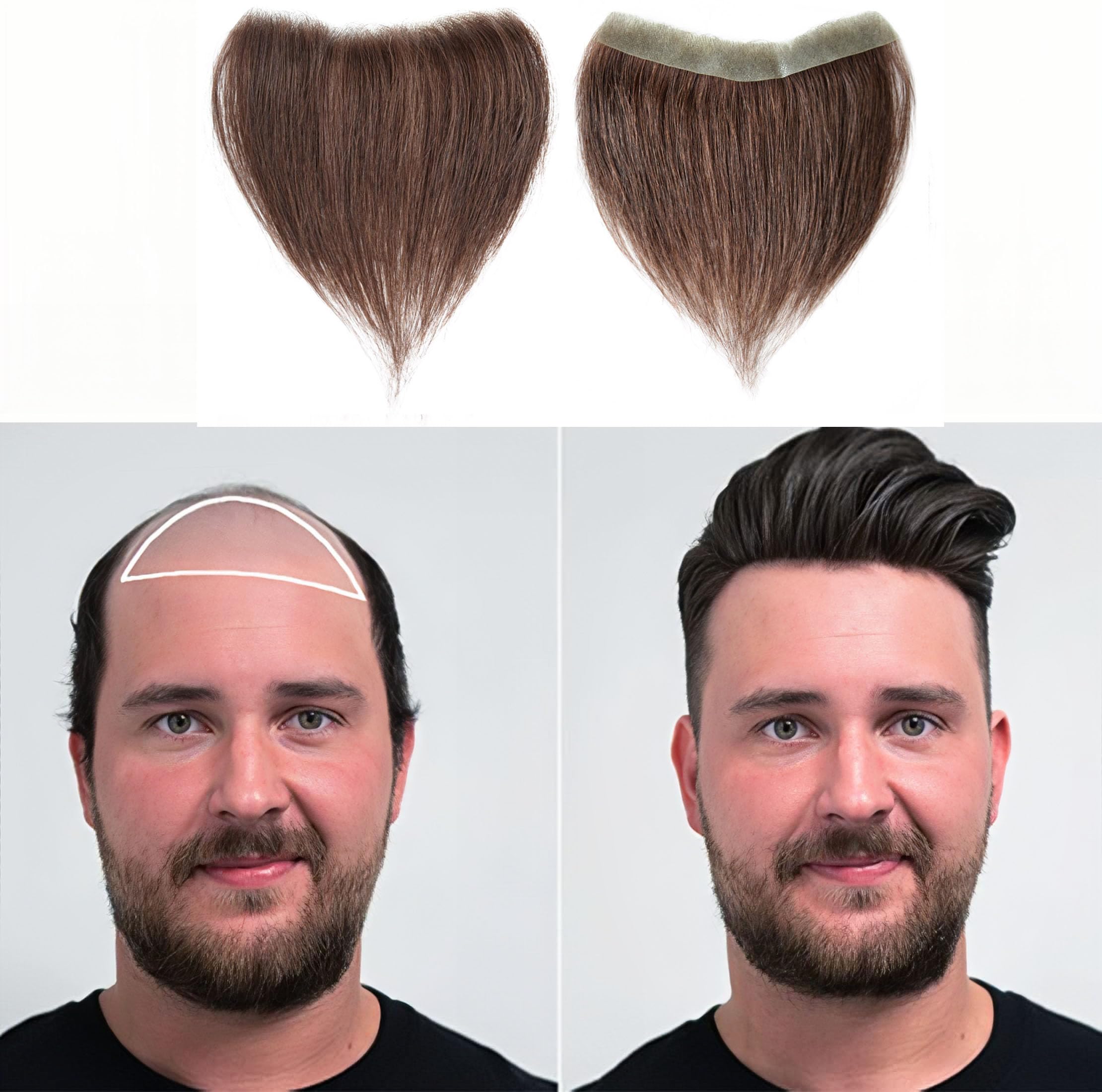 Frontal Hairpiece for Men Medium Brown Hair Extension Hairline Loss Straight Tape in Human Hair Toppers Replacement Toupee (0.78"x6.3", 6", Medium Brown)