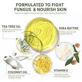 Roycederm Tea Tree Soap for Face & Body Acne, Athlete\'s Foot, Tinea, Folliculitis Ringworm Jock Itch - Pack of 2