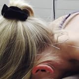 langenthaler fasnacht Treueprämien Akupunktur