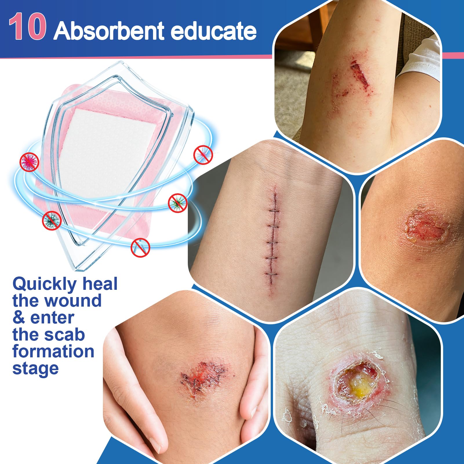 Silicone Foam Dressing with Border, FSA or HSA-Soft Pink Color(3"×3") — Amazon image 6