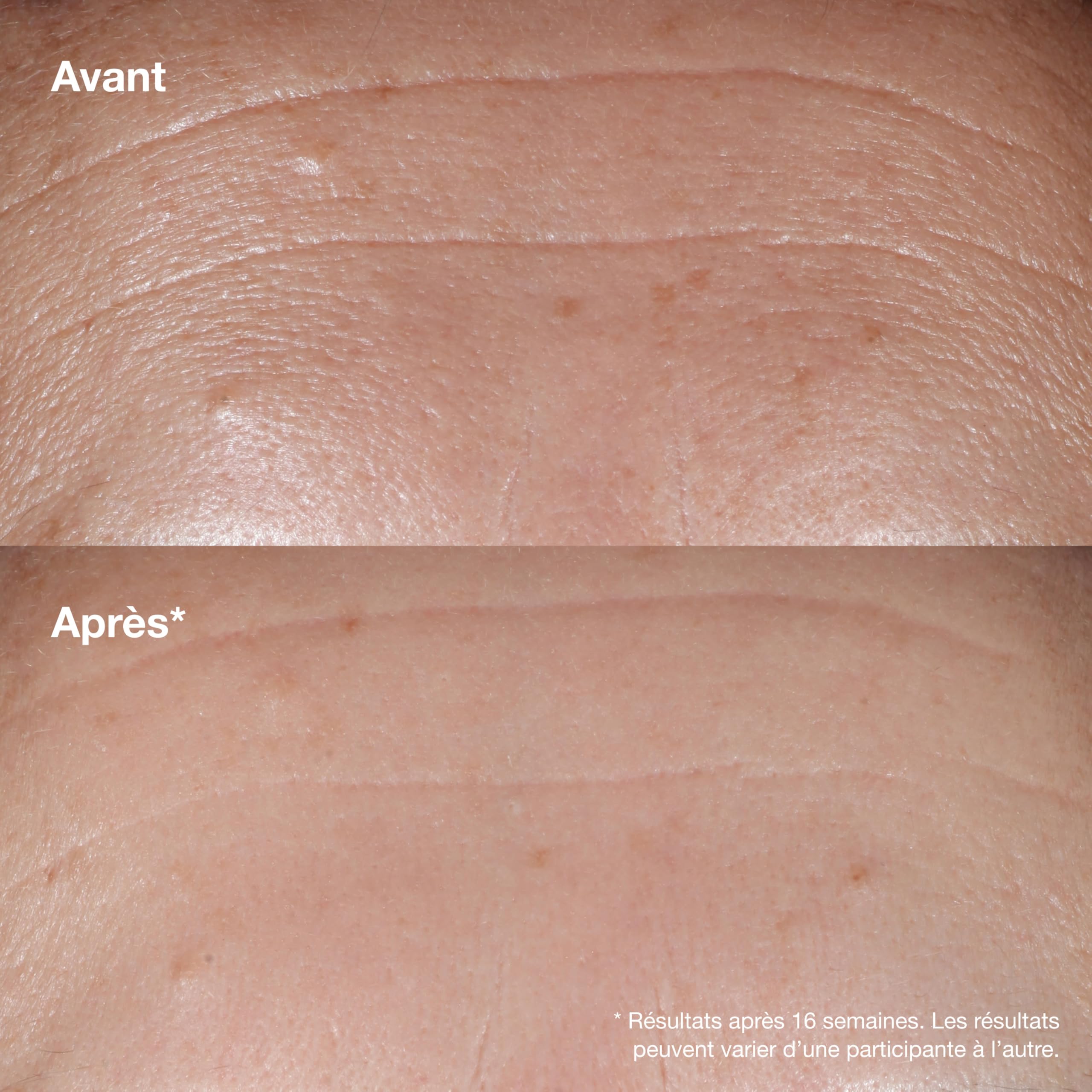 Clinique Smart Clinical Repair Sérum Visage Correcteur Anti-Rides Acide Hyaluronique, Peptides 9.5% + Rétinoïde 1% | Anti-Âge