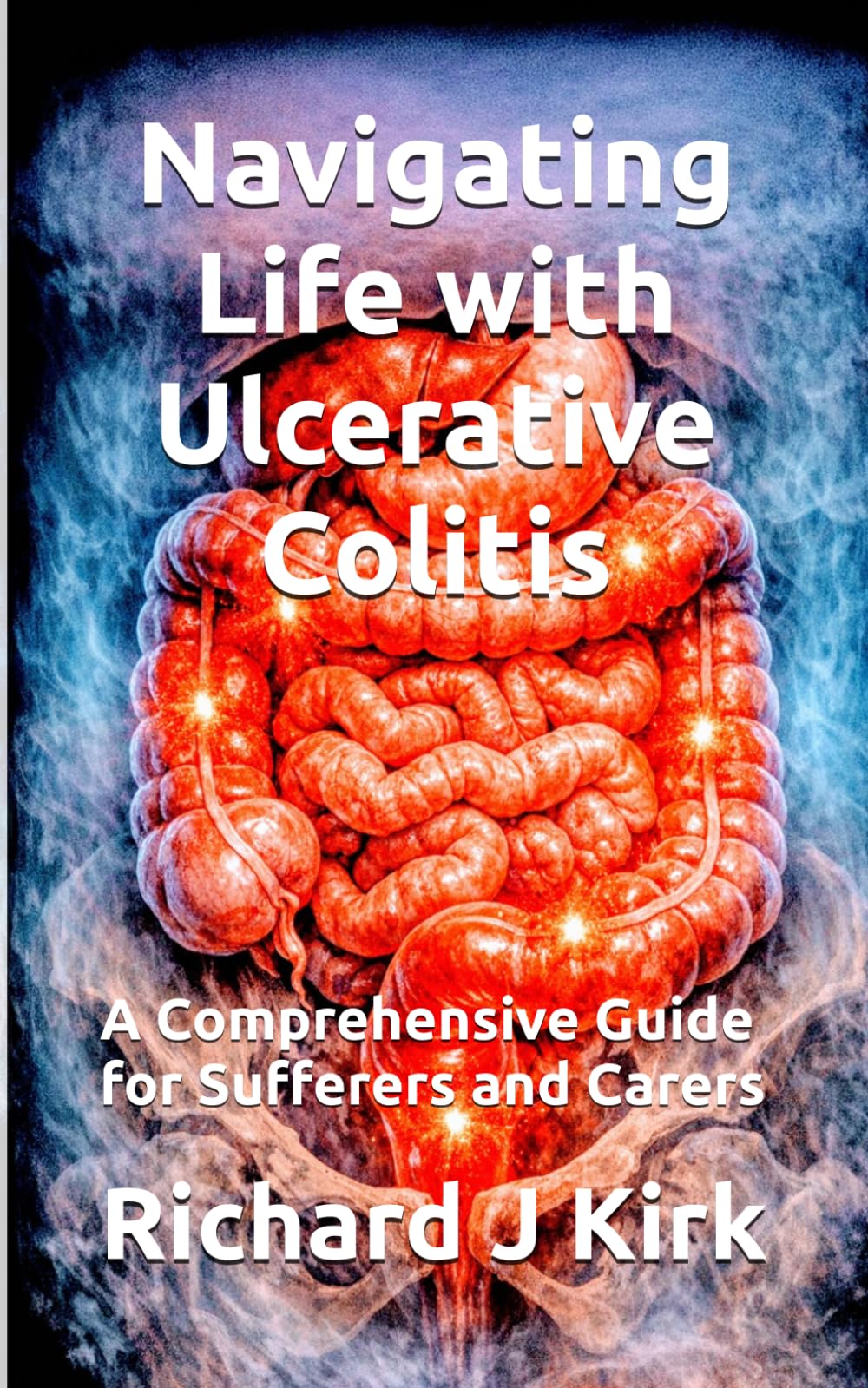 Navigating Life with Ulcerative Colitis: A Comprehensive Guide for Sufferers and Carers