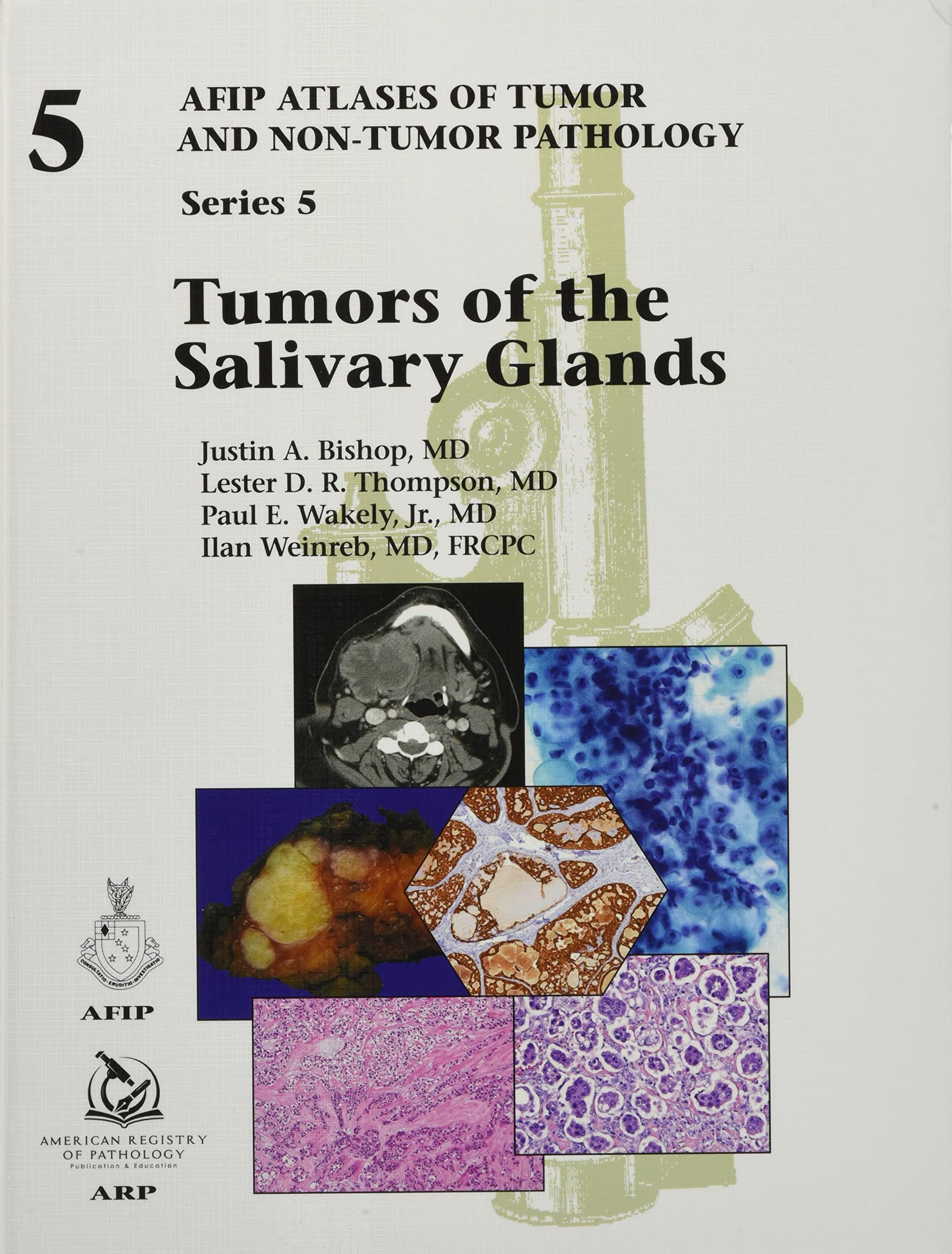 AFIP4th #14 Tumors of the Prostate(新本) AFIP4th #14 Tumors of the Prostate(新本) AFIP4th #14 Tumors