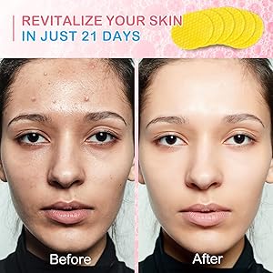 Turmeric Cleansing Pads, Kojic Acid Cleansing Pads - Gentle and Effective Daily Skincare for Face and Body