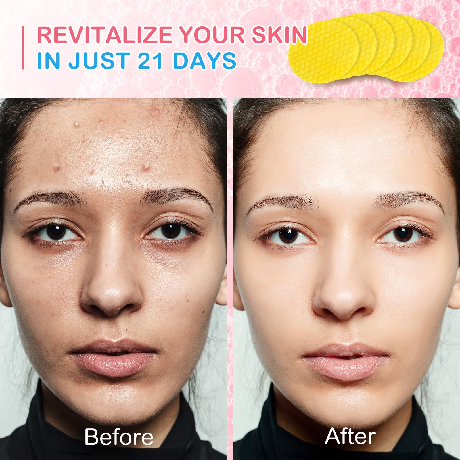 Pads Nettoyants à l'Acide Kojique et au Curcuma - Illumine et Revitalise la Peau | Nettoie en Profondeur, Élimine l'Excès de Kératine, Raffermit le Visage, Traite l'Acné et les Taches Brunes