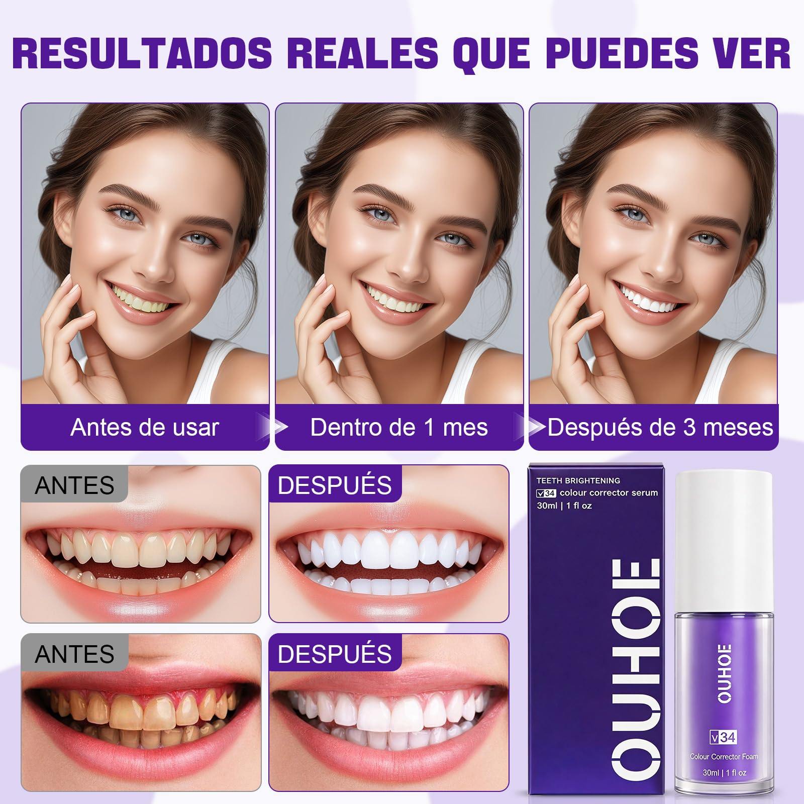 2PCS Púrpura Blanqueador Dental Profesional,Pasta Blanqueadores Dientes,Blanqueamiento Dental Eliminación Profunda de Manchas,Eficaz Para Fortalecer Dientes y Encías,Suave Para Dientes Sensibles - 5