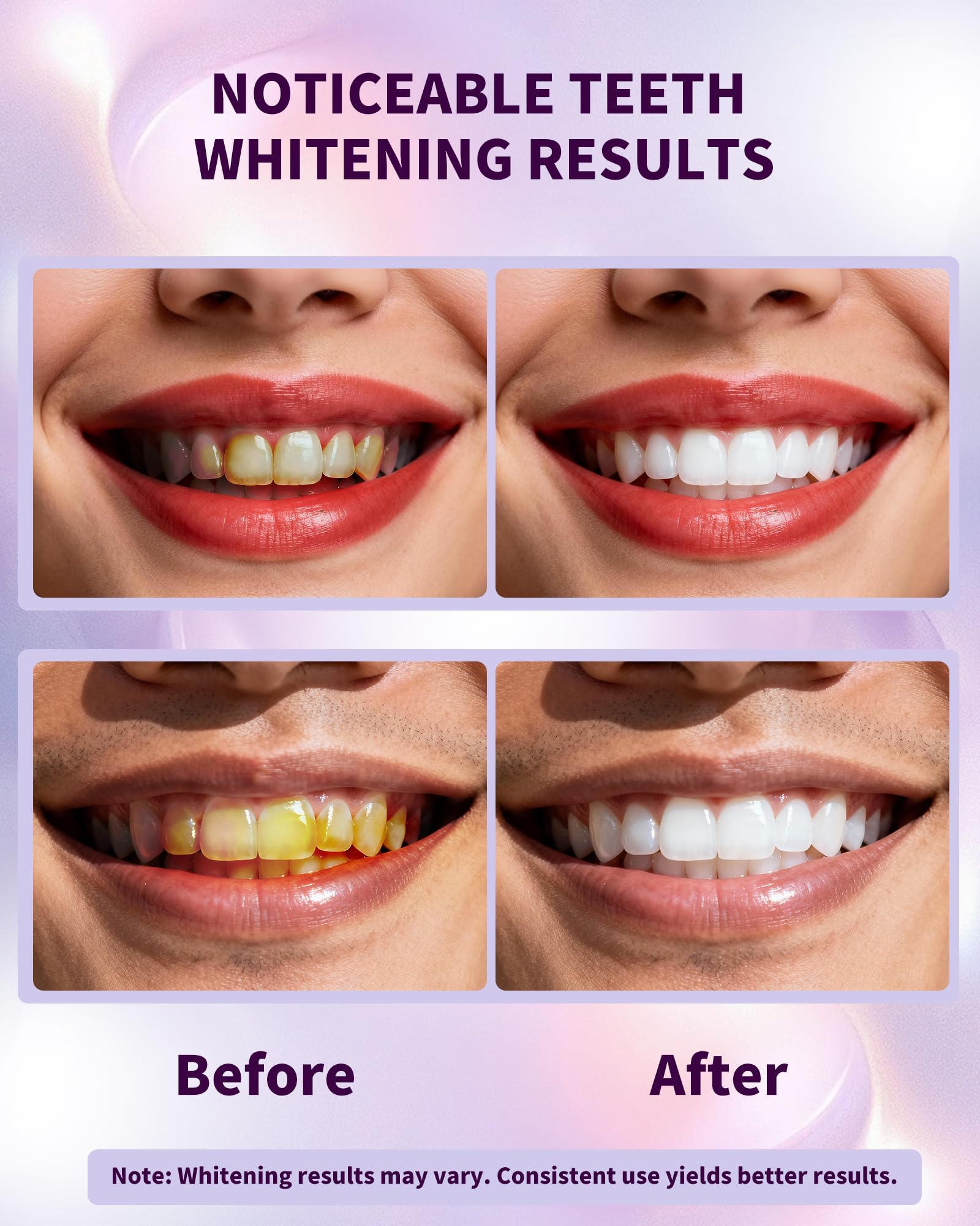 Purple Whitening Strips, Color Correcting Purple Teeth Whitening Strips, Removes Yellow Stains, Enamel Safe for Sensitive Tooth, 30 Min Treatment, 14 Treatmetnts, 28 Strips — view 3