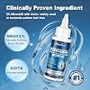 Paquete de 8, Suero de crecimiento para cabello y barba con 5% de Minoxidil, con Biotina y Aceite de Ricino, Minoxidil para hombres y mujeres, favorece un cabello más grueso y abundante, reduce el adelgazamiento y la caída del cabello, suministro para 8 meses 3