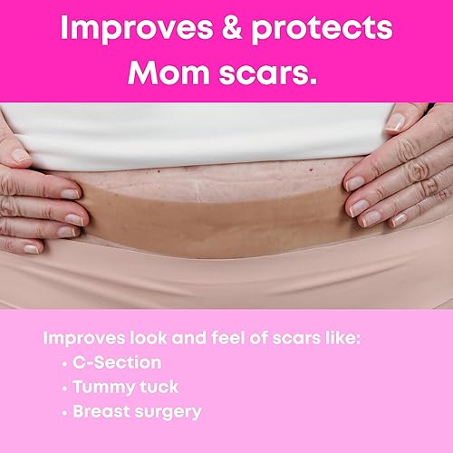 Miniatura 4 de Hojas de silicona para cicatrices, cinta de silicona de grado médico, personalizadas para mamás, extra largas de 1.6 x 120 pulgadas, perforaciones