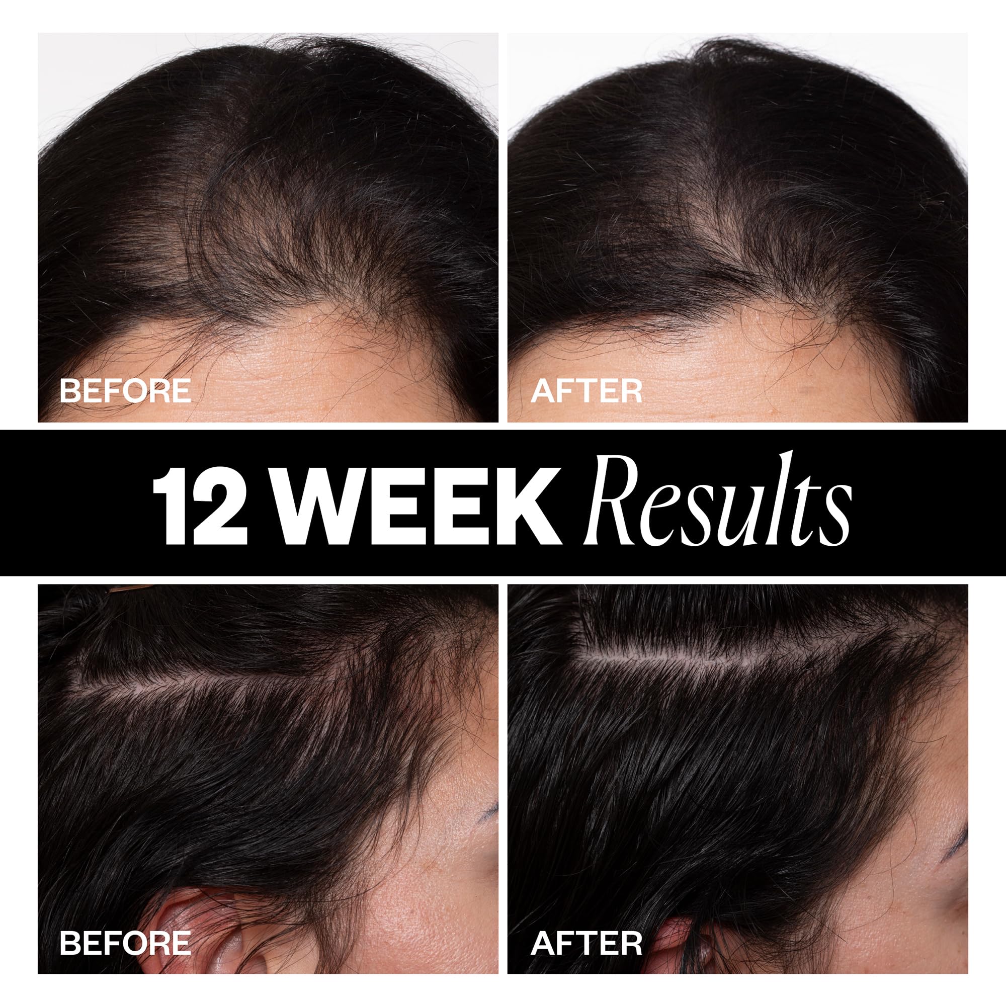 IGK Sponsored - Scalp Treatment for Hair Growth – Hair Thickening Serum for Women – Promotes Fuller, Thicker Hair – Scalp Serum for Hair Density and Thinning - 2.1oz