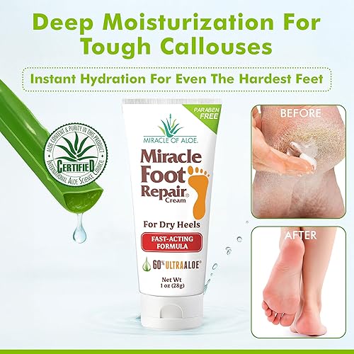 Miniatura 7 de Miracle Foot Repair Cream (1 onza12 unidades) repara talones y pies secos agrietados, seguro para diabéticos, 60% puro ultra aloe hidrata, suaviza y