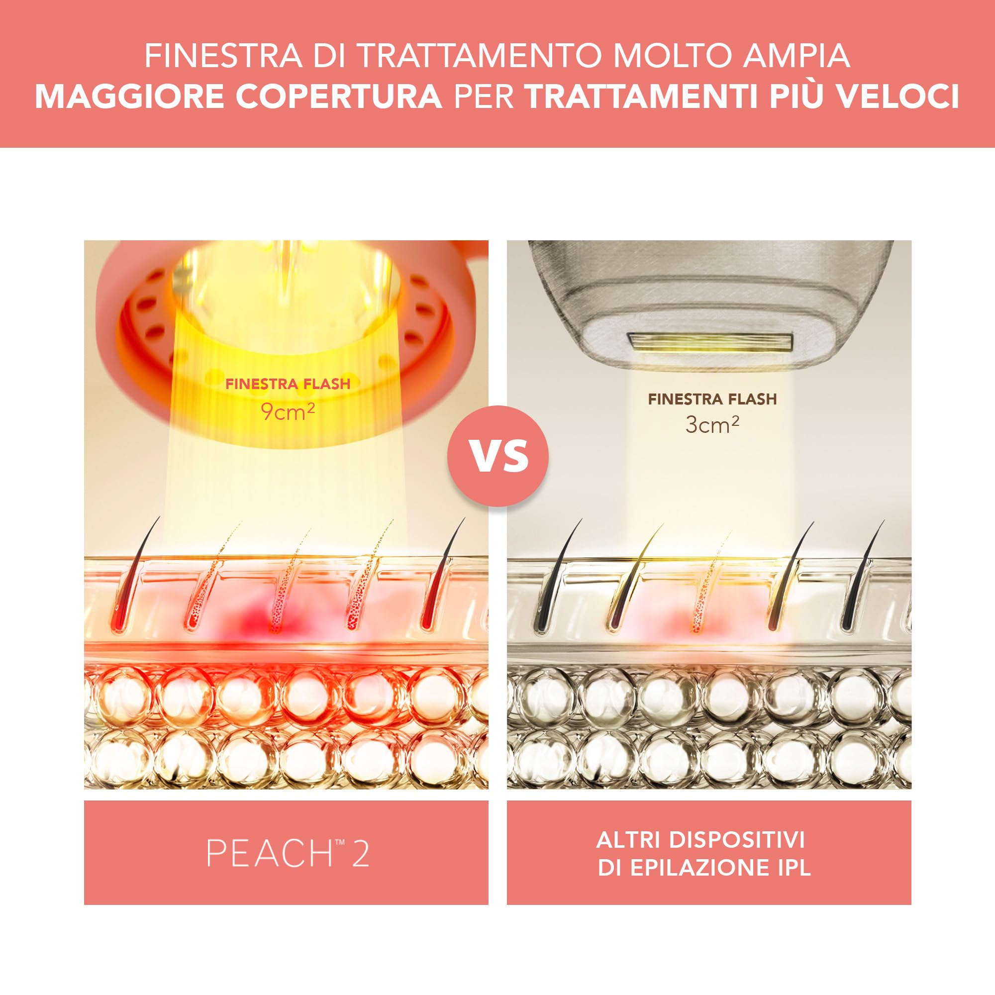 FOREO PEACH 2 Dispositivo Per Epilazione IPL + Gel Lenitivo Pre-IPL | Epilazione IPL, Epilazione Laser, Raffreddamento Pelle, Gel Rinfrescante, Corpo Intero, Zona Bikini, Viso