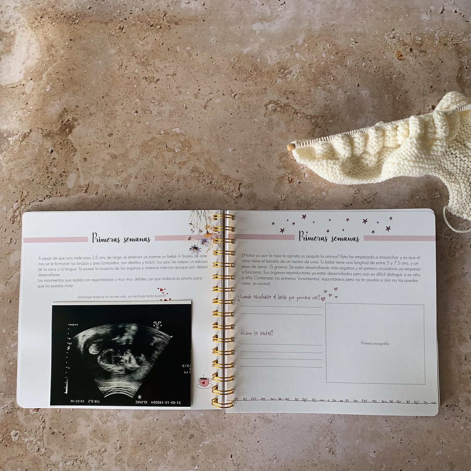 SUSIKO - Diario de Embarazo 'Y Aquí Comienza Nuestra Historia' | Diseñado con Cariño para Acompañarte en todo Momento | Un Tesoro para Fotos, Notas y Recuerdos | Regalo Ideal para Futuras Mamás