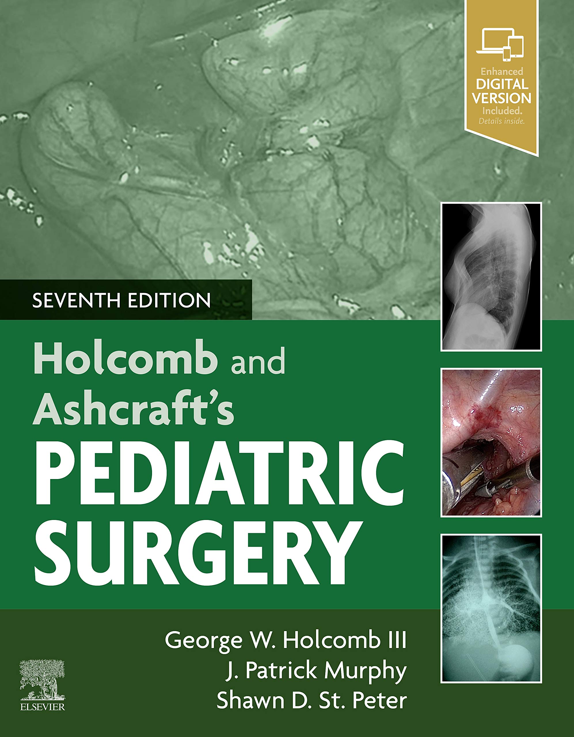 Holcomb and Ashcraft's Pediatric Surgery: Expert Consult - Online + Print 7th Edition