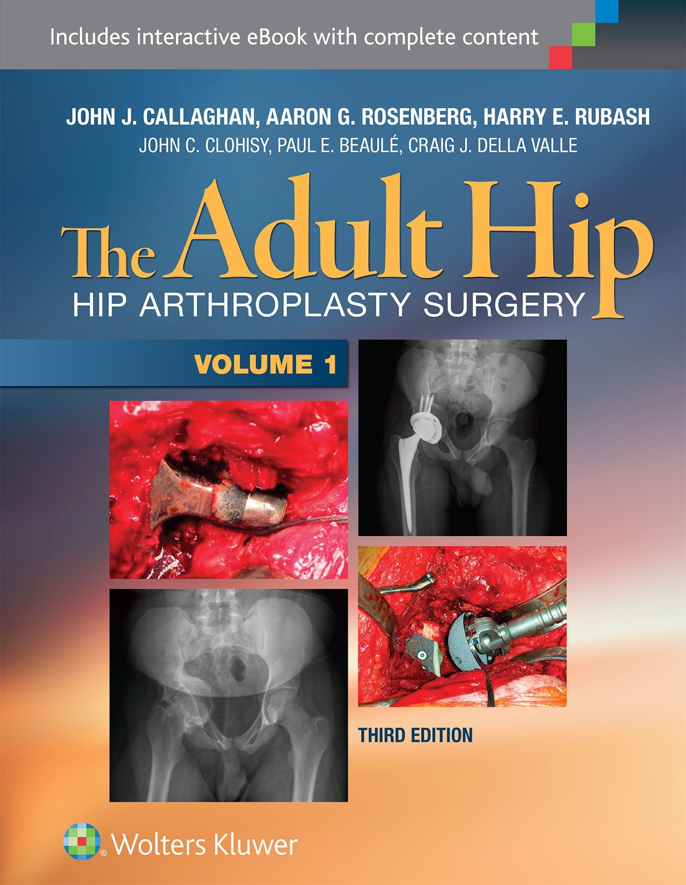 The Adult Hip (Two Volume Set): Hip Arthroplasty Surgery Hardcover – 1 Nov. 2015