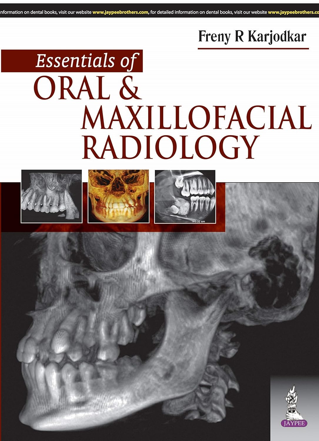 Essentials Of Oral & Maxillofacial Radiology eBook Karjodkar, Freny R Kindle Store