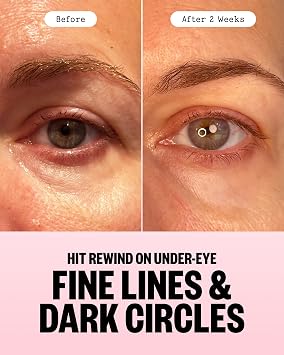 PEACE OUT Retinol Eye Jelly Stick, Hydrating Under Eye Treatment for Fine Lines & Wrinkles, with Encapsulated Retinol, Peptides & Squalane, Non-Irritating Formula (0.14 oz)