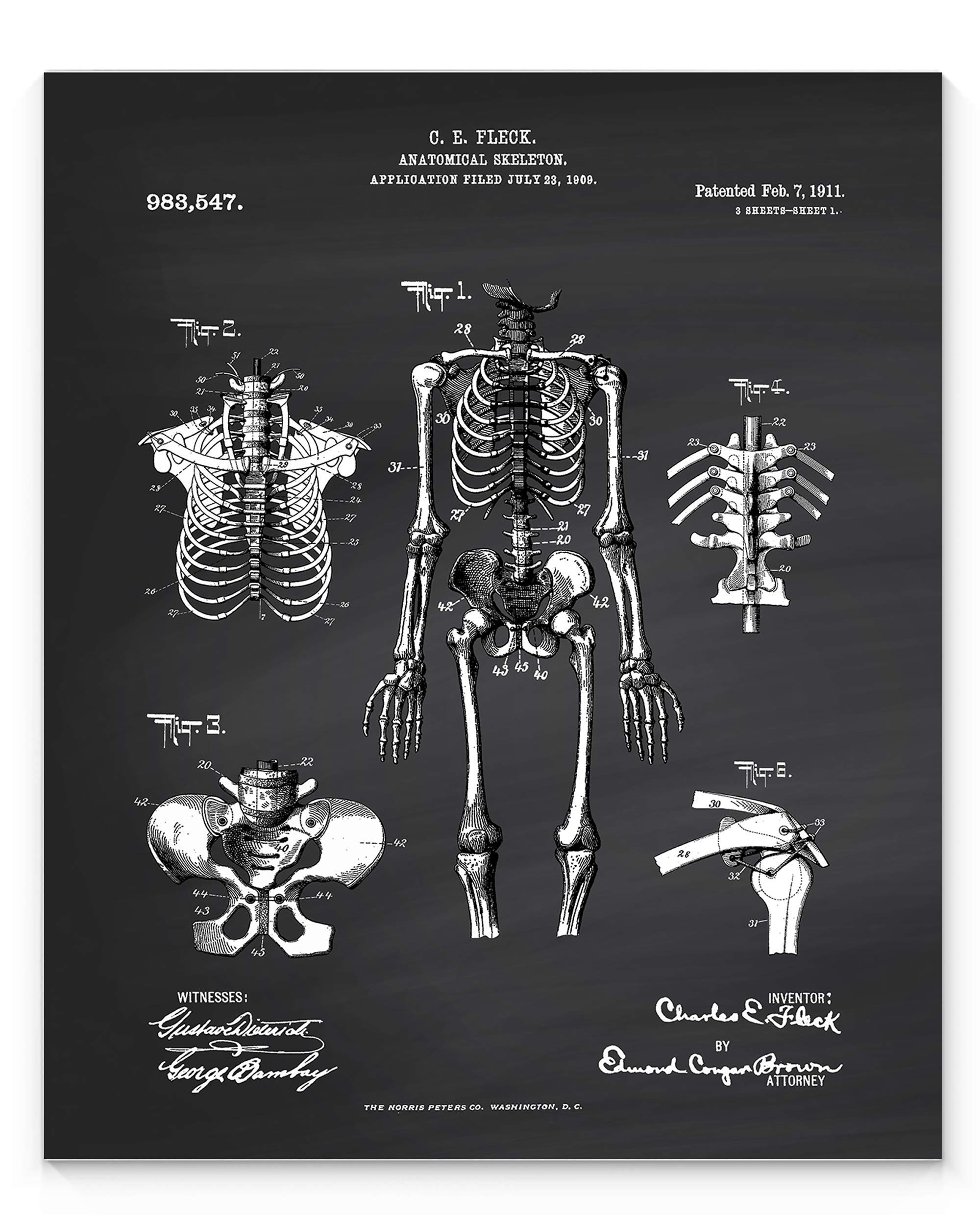 Skeleton Chalkboard Style Patent Wall Art Print 11x14 inch, Ideal for Doctors, Medical Professionals, Students, Nurses, EMI