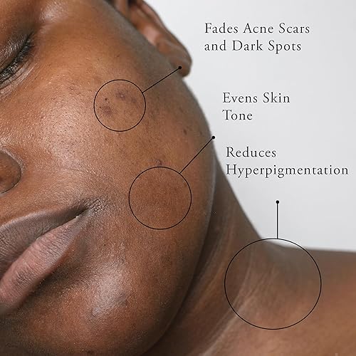 Miniatura 3 de Mascarilla facial de cúrcuma con vitamina C para manchas oscuras e hiperpigmentación  Niacinamida  Probióticos