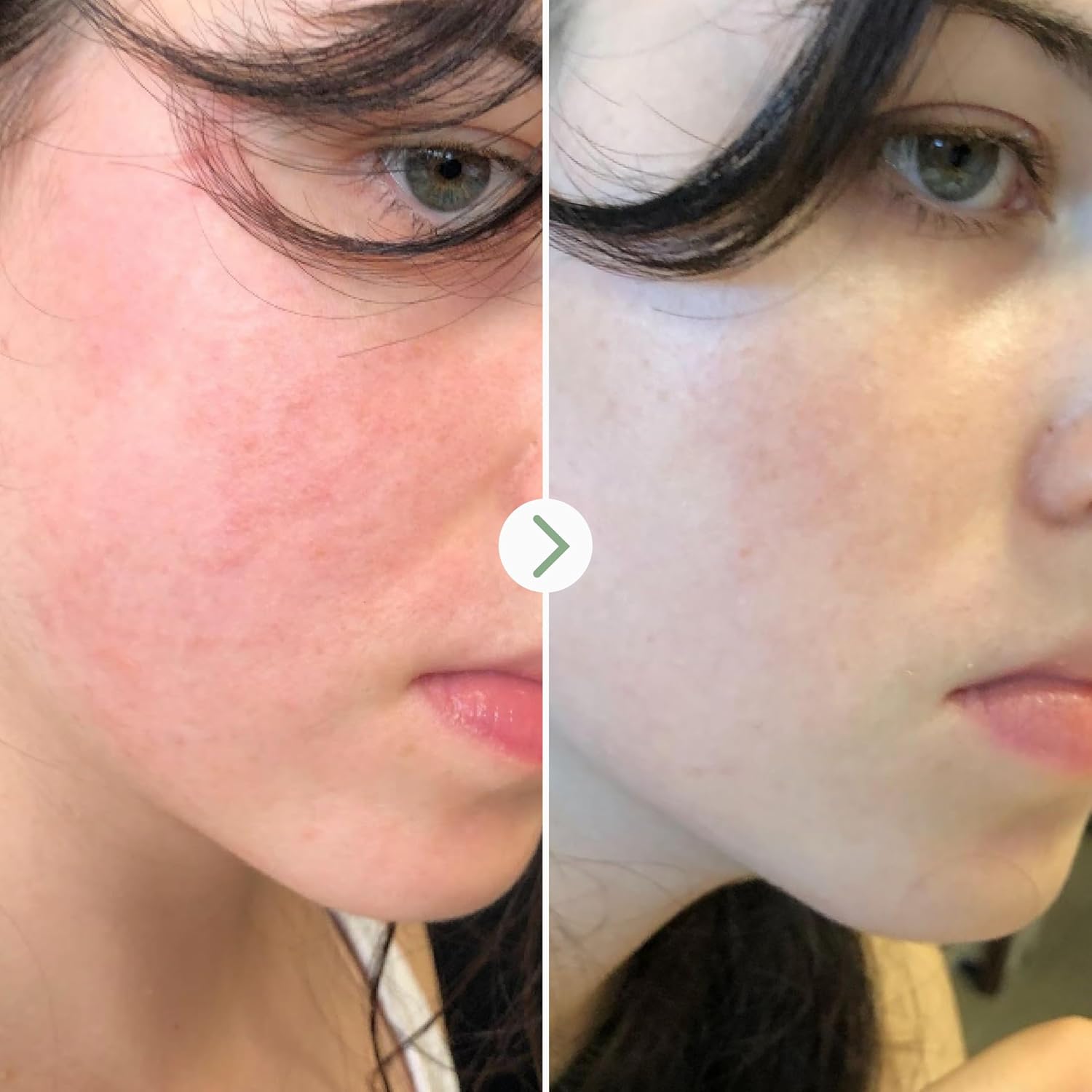 PAI SKINCARE - The Light Fantastic Organic Ceramide Face Oil | Natural, Vegan, Sensitive Skincare (1 fl oz | 30 mL) - Image 5