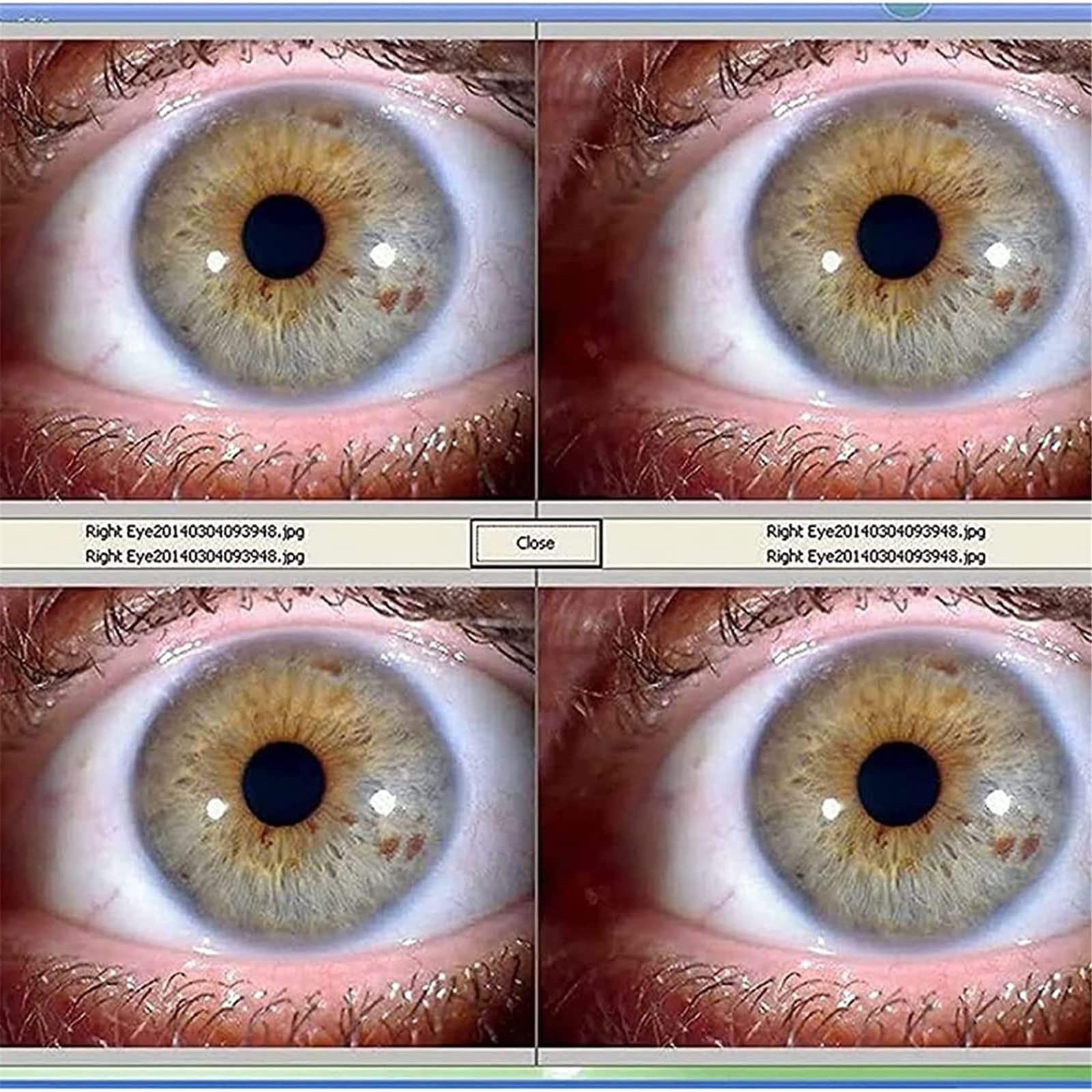 診断革命 : 虹彩診断による治療と予防 : 東洋虹彩分析 診断革命 : 虹彩診断による治療と予防 : 東洋虹彩分析
