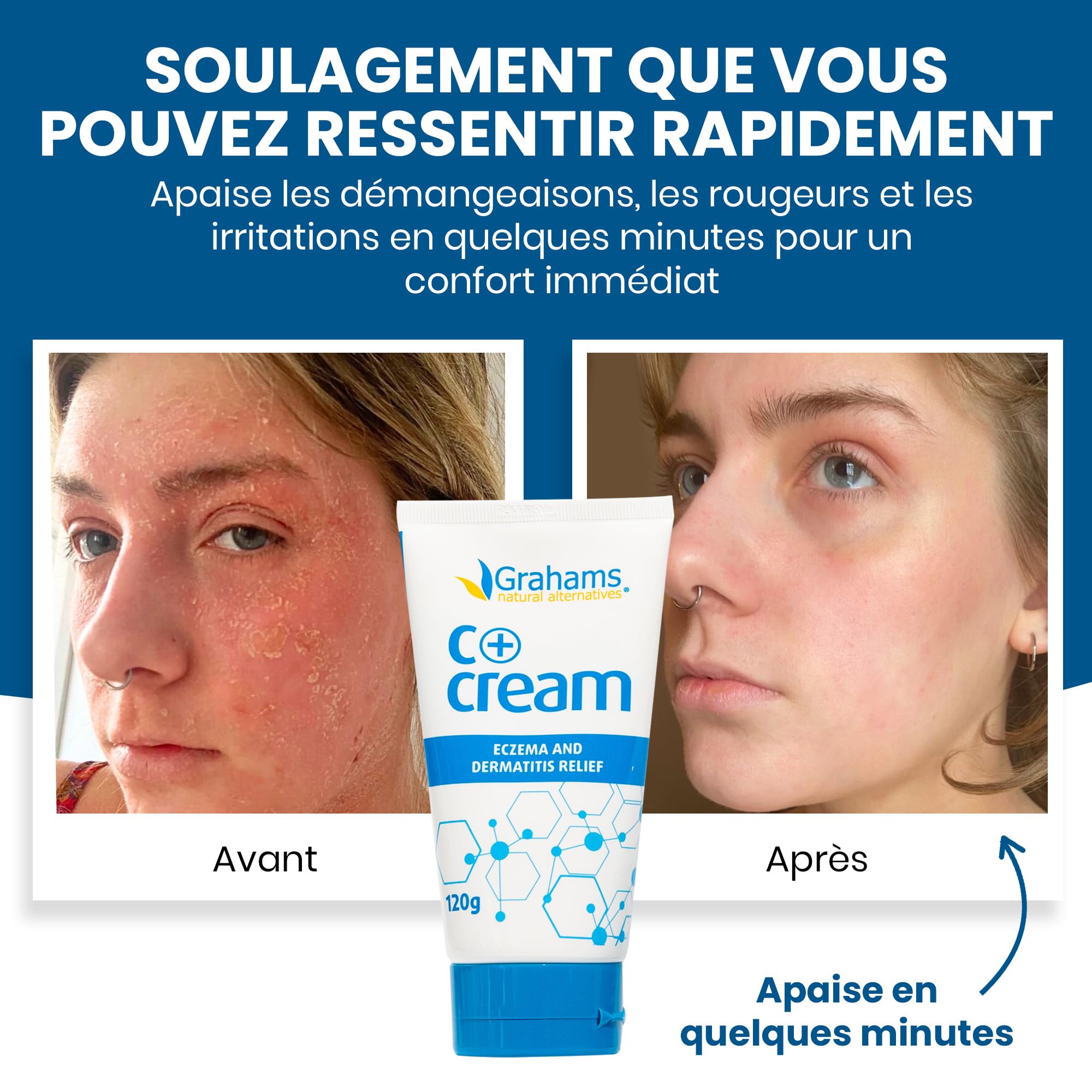 Grahams Natural C+ Cream - Crème Pour Peaux Sèches, Démangeantes, Rouges et à Tendance Eczémateuse - Au Miel de Manuka et au Calendula - Sans Stéroïdes, Non Grasse, Convient aux Peaux Sensibles, 120g