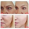 Skin Care Facial Beauty Aqua Peel Solution 400 ml Per Bottle Face Cleansing And Moisturizing Elitzia ETYYS123