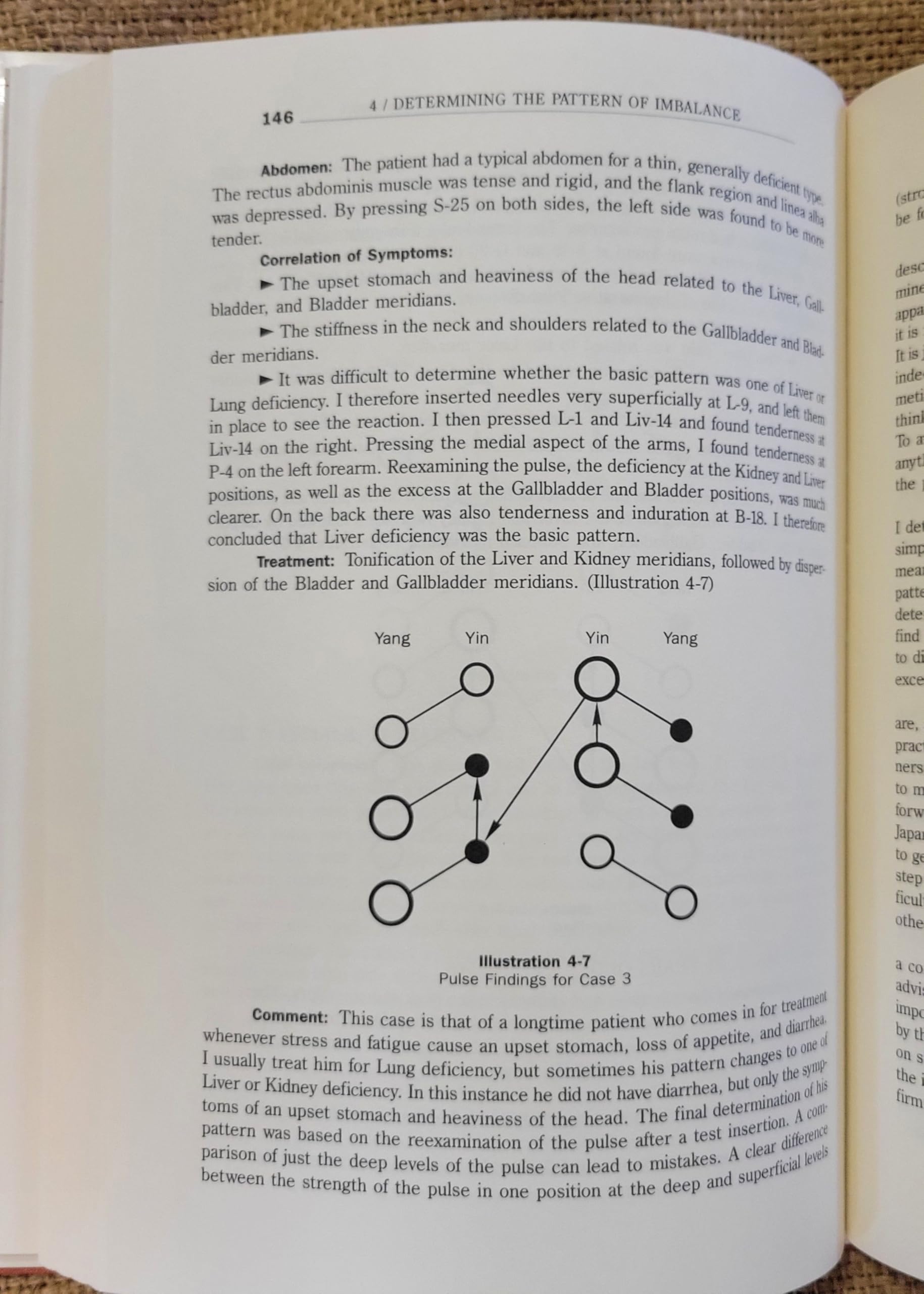 Japanese Classical Acupuncture: Introduction to Meridian Therapy