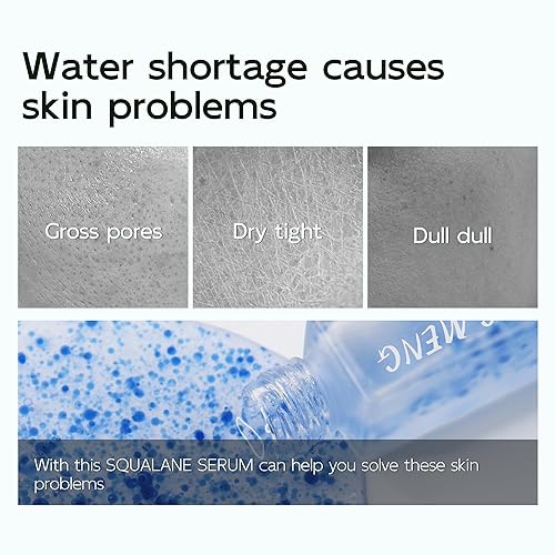 Miniatura 7 de JING MENG SUERO DE CALANO, SUERO B5, SERUM PRO VITAMINA C, SUERO DE RETINOL LIPOSOMAL, SENTIMIENTO ÚNICO, SALUDA A LA CARA DEL BEBÉ, REGALO DE