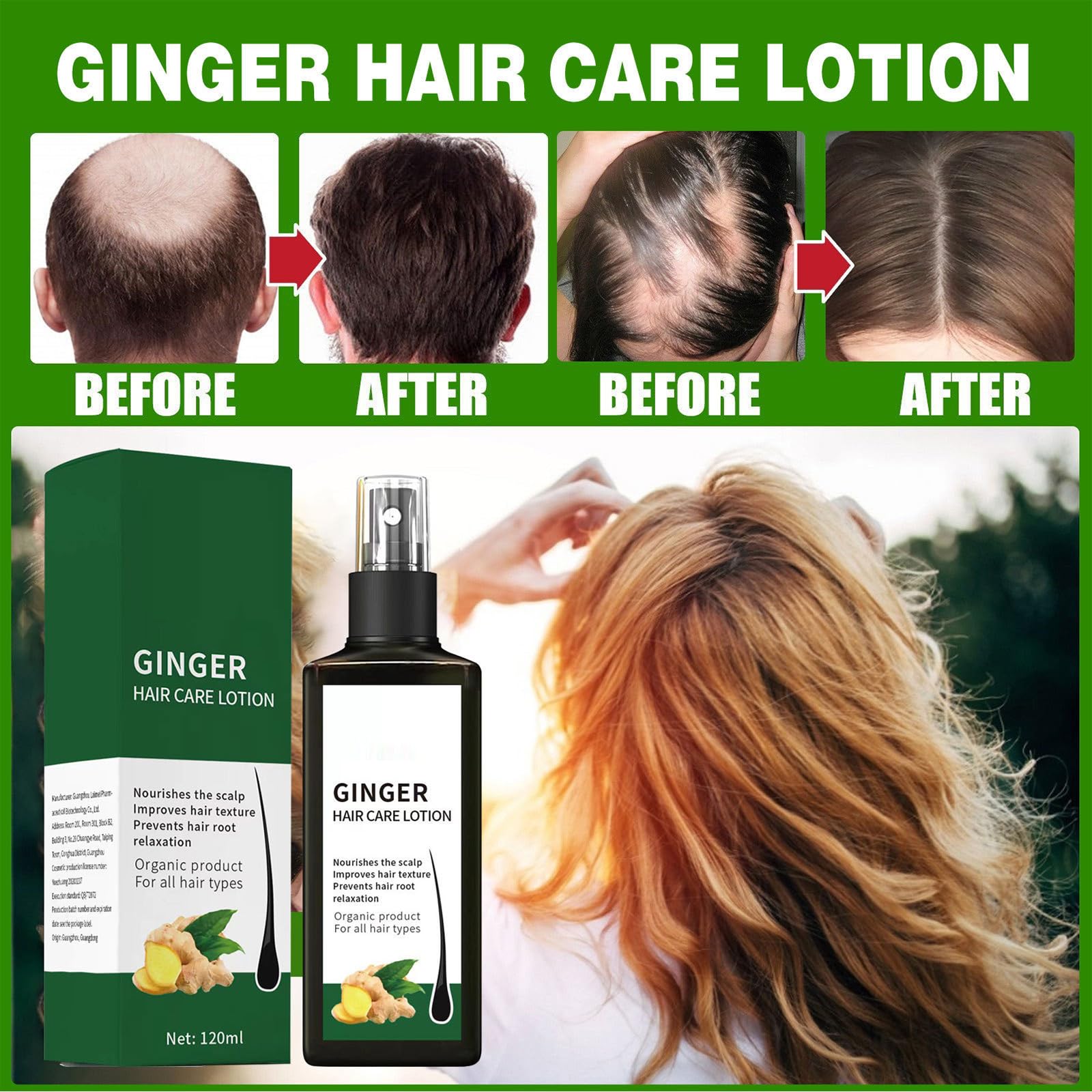 Spray Nourrissant Au Gingembre 120ml, Sérum De Croissance Des Cheveux Au Gingembre, Volume & Brillance, Pour Cheveux Fins Et Secs, Réparateur Nettoyant En Profondeur