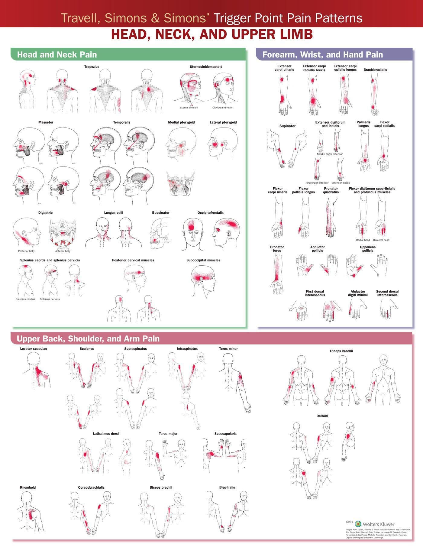 Travell, Simons & Simons Trigger Point Pain Patterns Wall Chart: Head, Neck, and Upper Limb